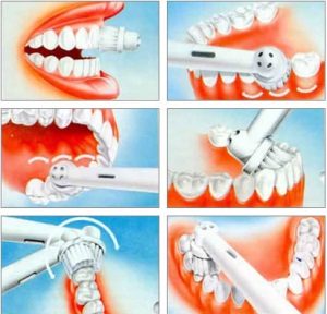 Выбор зубной электрощетки: 11 основных рекомендаций и нюансов для покупателей + топ лучших моделей